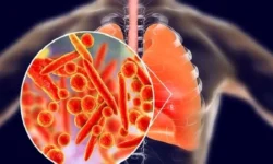 بیماری انسدادی مزمن ریه چهارمین علت مرگ‌ و میر جهان!