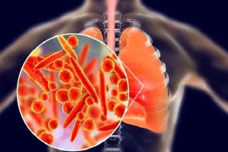 بیماری انسدادی مزمن ریه چهارمین علت مرگ‌ و میر جهان!